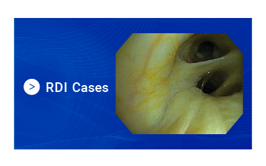 RDI Cases