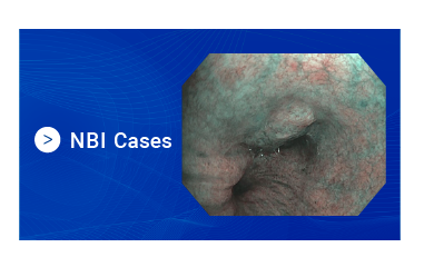 NBI Cases