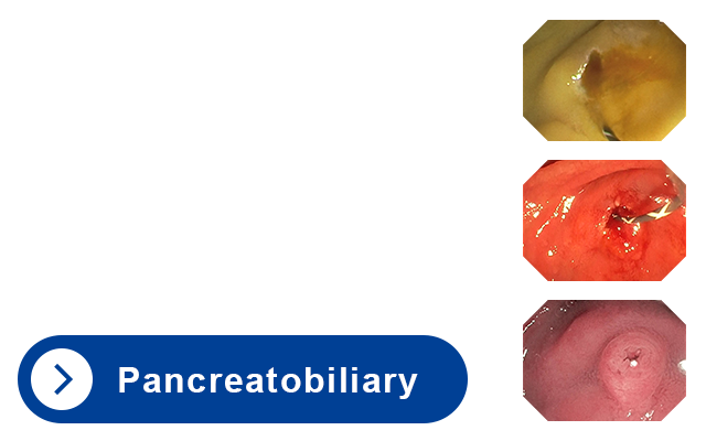 Pancreatobiliary