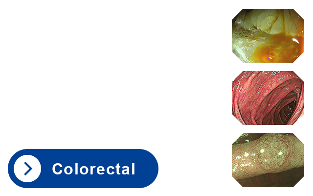 Colorectal