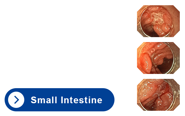 Small Intestine