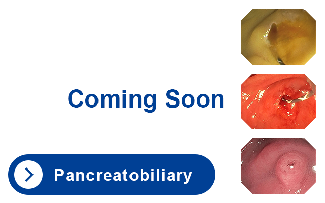 Pancreatobiliary