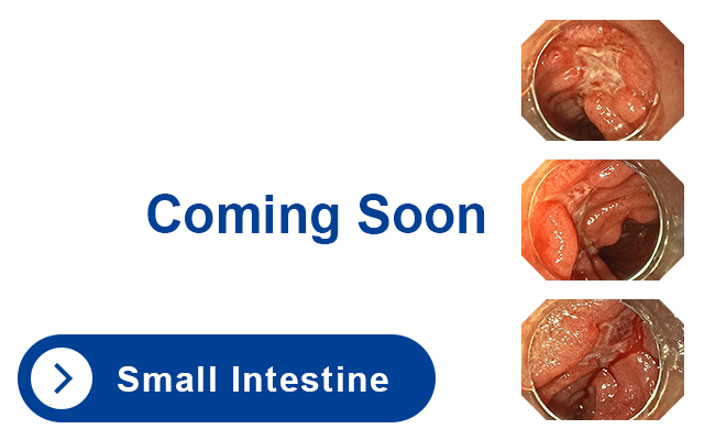 Small Intestine