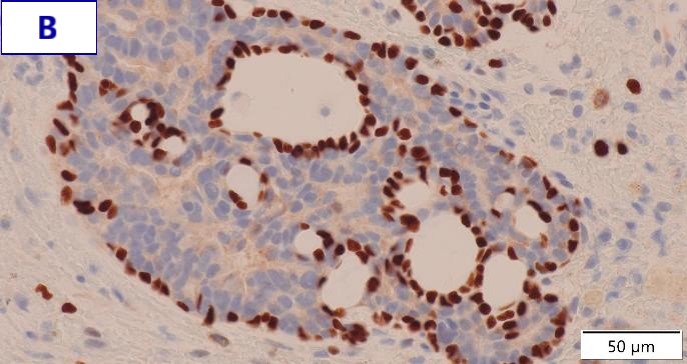 EVIS X1 症例画像集 -RDI - Olympus Professional Education On-Demand Library