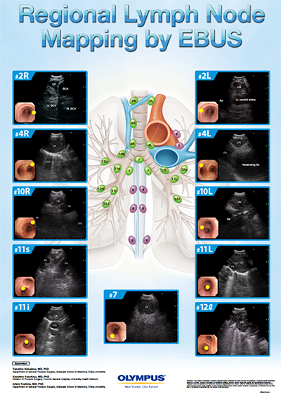 Thoracic Lymph Node Anatomy - Olympus Professional Education On-Demand