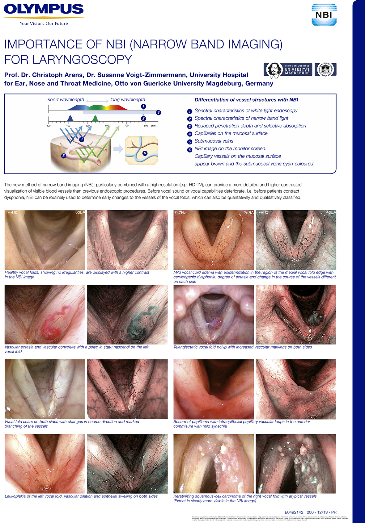 IMPORTANCE OF NBI FOR LARYNGOSCOPY