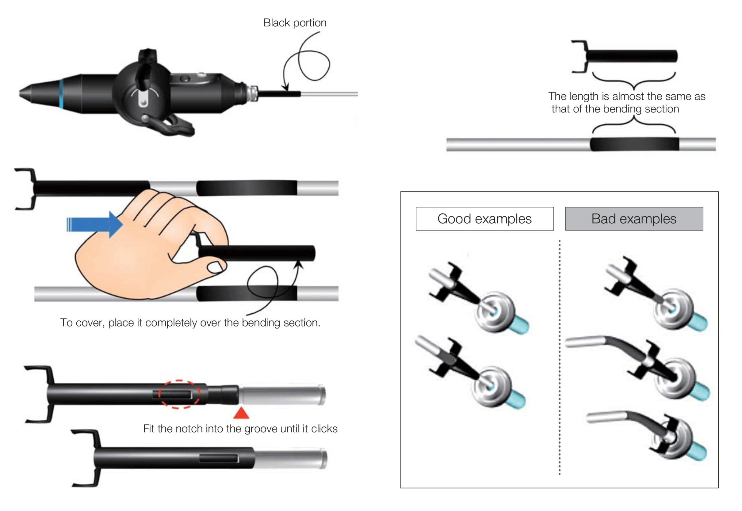 How to use the ENDOEYE FLEX Deflectable Videoscope - Olympus Professional  Education On-Demand Library