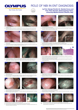 Role of NBI in ENT diagnosis