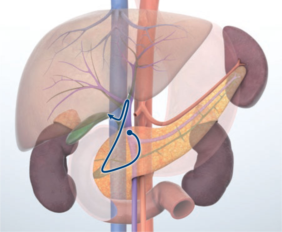 Transduodenal bulb approach