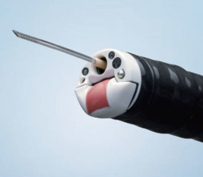 Standard Imaging Methods Using a Convex Ultrasonic Endoscope for EUS ...