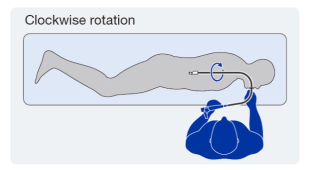 Clockwise rotation