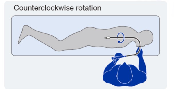 Counterclockwise rotation