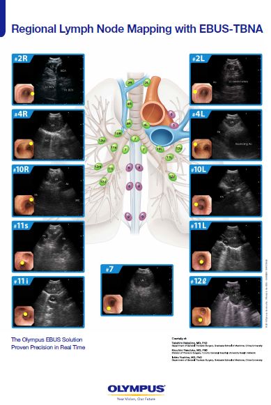 Thoracic Lymph Node Anatomy Olympus Professional Education On Demand