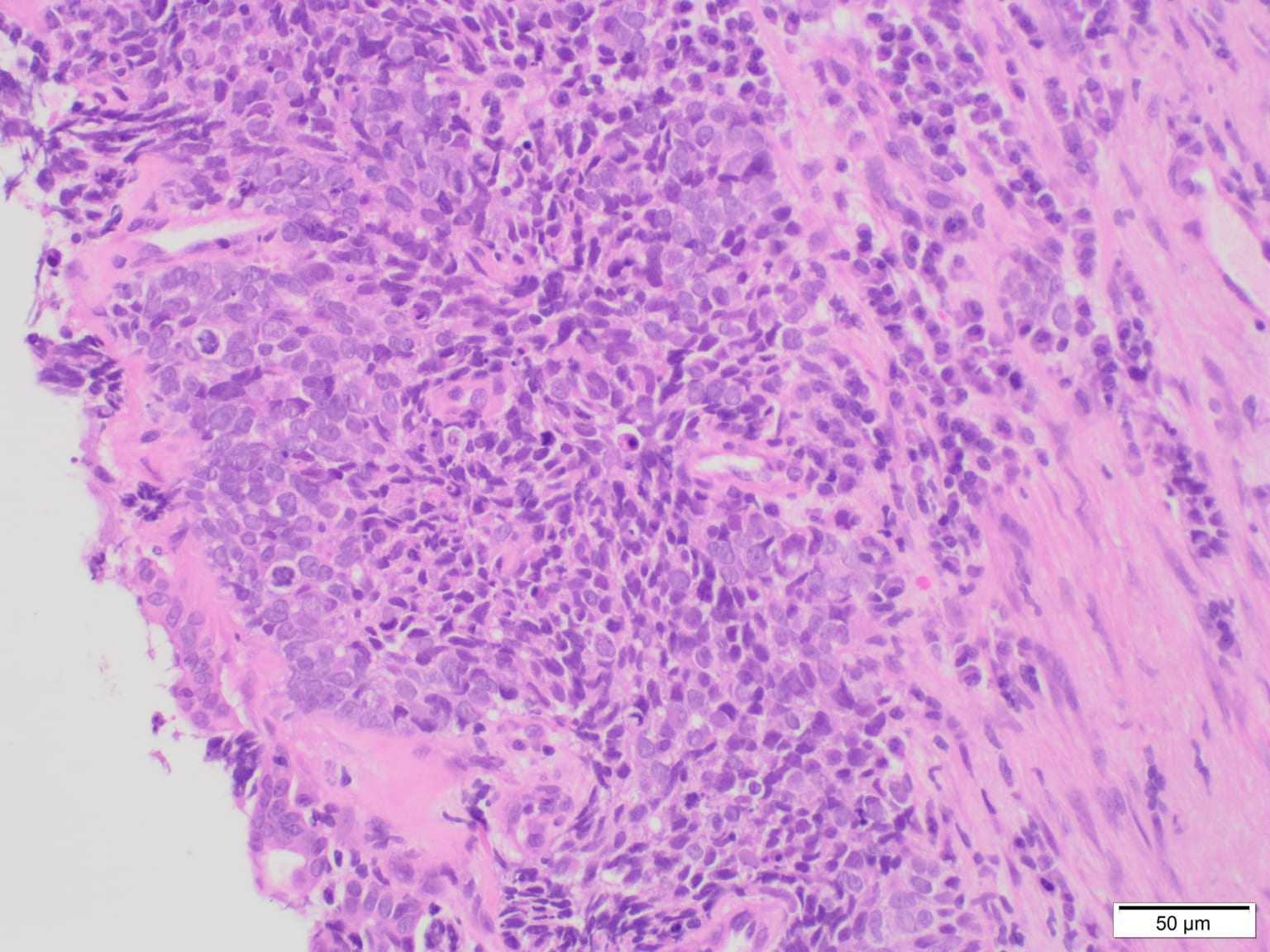 EVIS X1 Respiratory Imaging Atlas- RDI - Olympus Professional Education ...