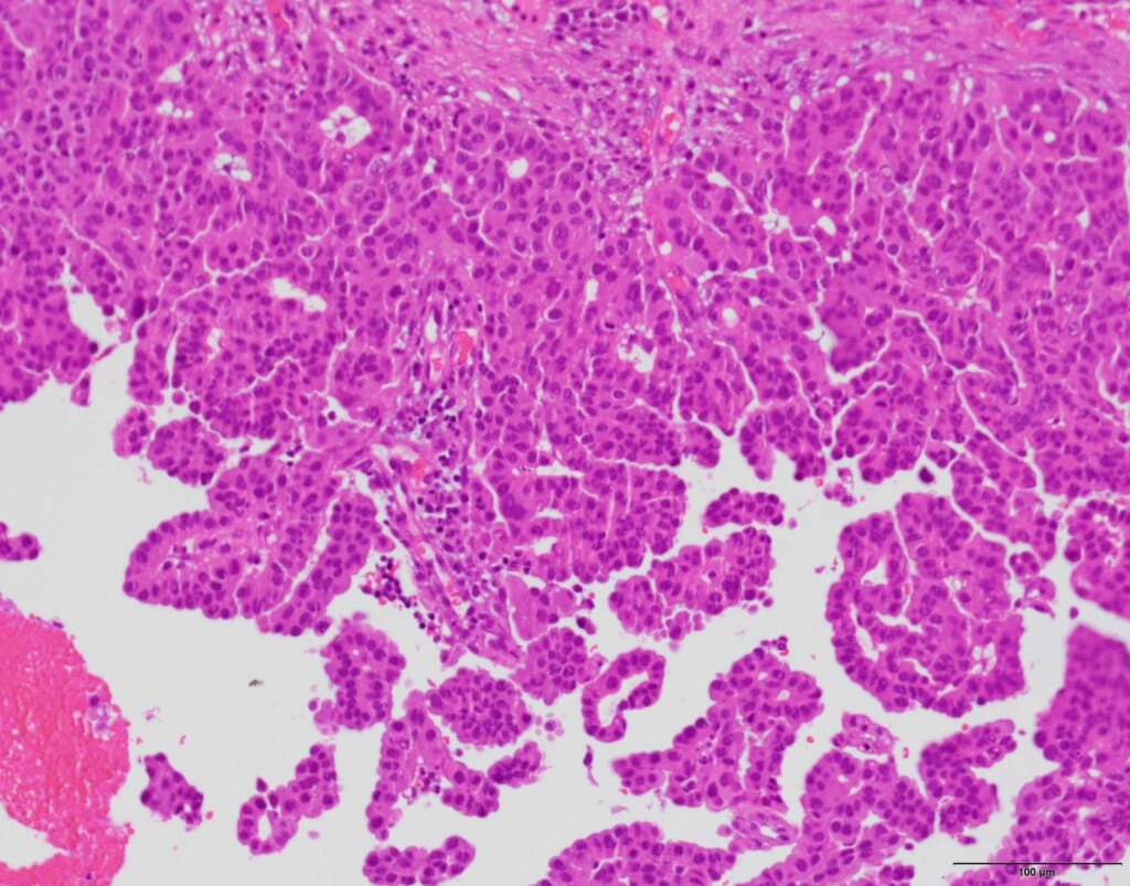 EVIS X1 Respiratory Imaging Atlas- RDI - Olympus Professional Education ...