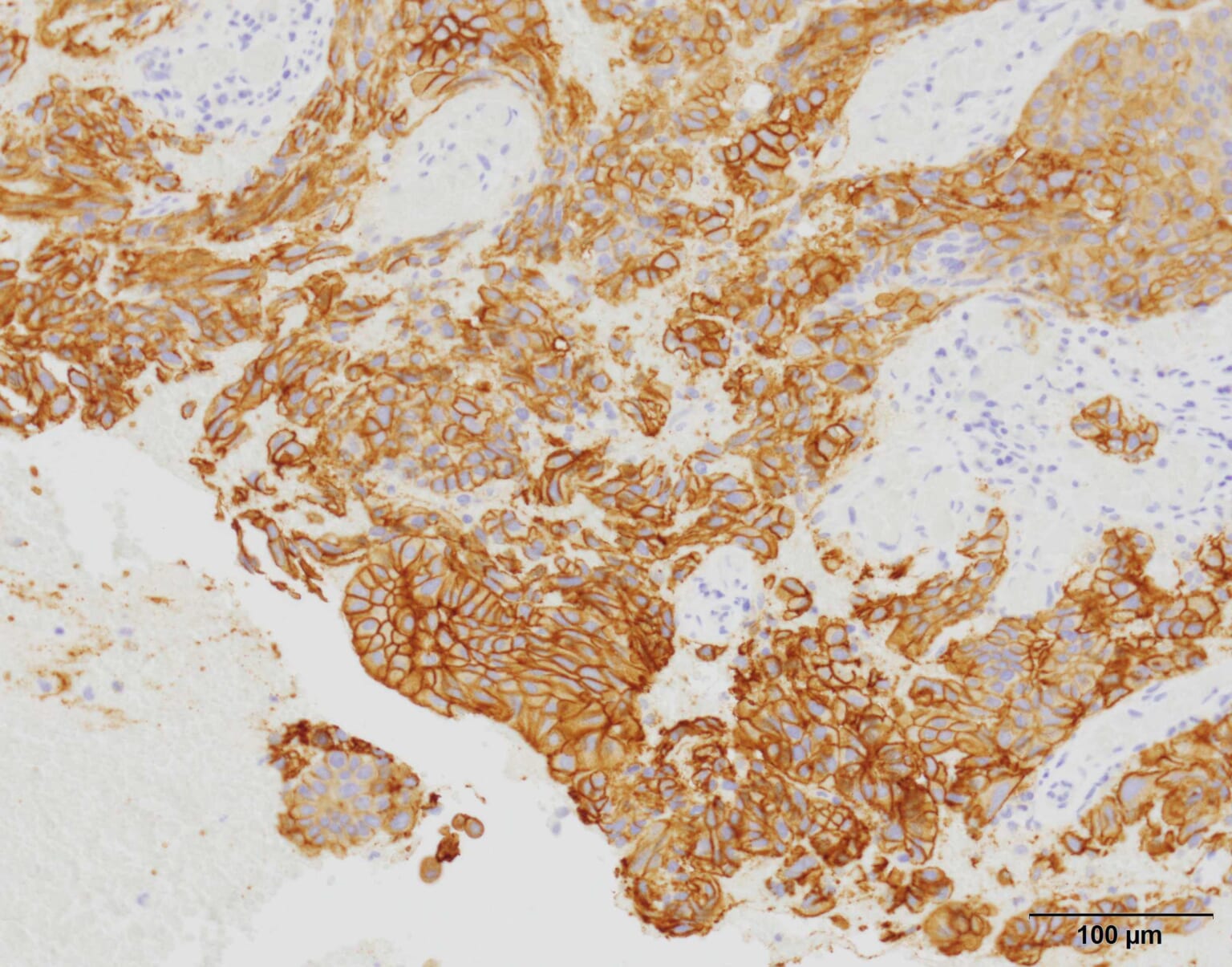 EVIS X1 Respiratory Imaging Atlas- RDI - Olympus Professional Education ...