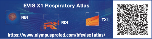 EVIS-X1-in Bronchoscopy-with-qrcode