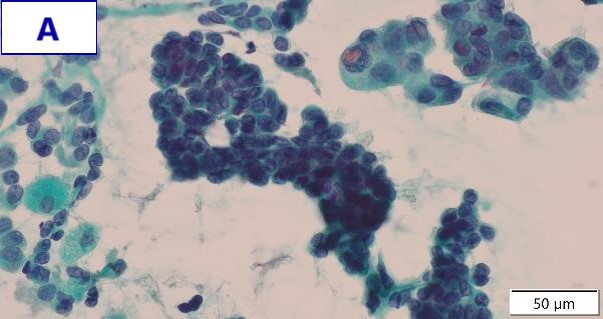 EVIS X1 Atlas ― RDI - Olympus Professional Education On-Demand Library