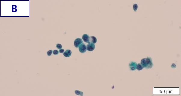 EVIS X1 Atlas ― RDI - Olympus Professional Education On-Demand Library