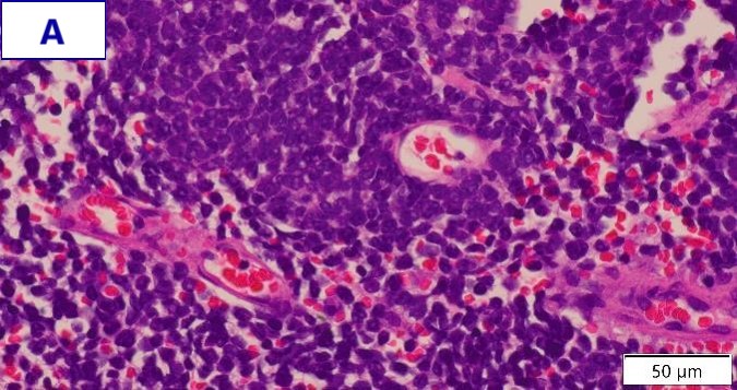 EVIS X1 Atlas -RDI - Olympus Professional Education On-Demand Library